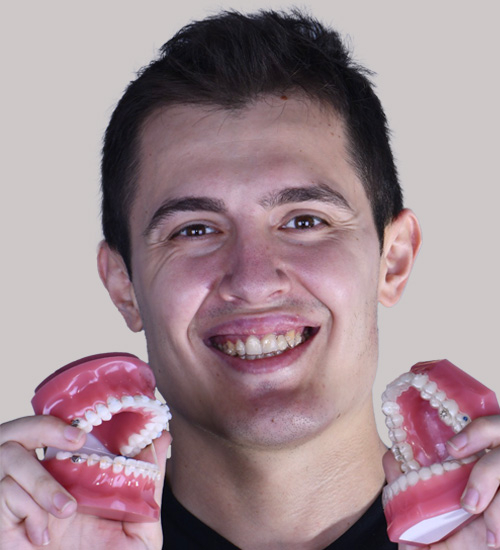 Furkan Açıkgözoğlu Orthodontics