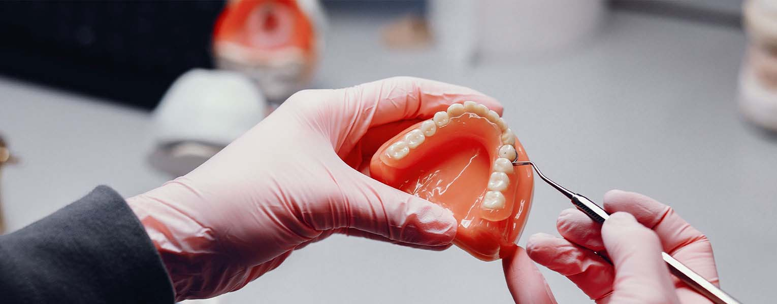 Precision Attachment Removable Partial Dentures